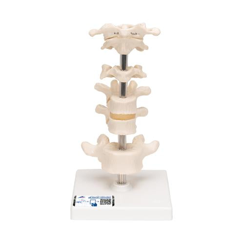 Model of 6 Human Vertebrae, Mounted on Stand (atlas, axis, cervical, 2x thoracic, lumbar) - 3B Smart Anatomy