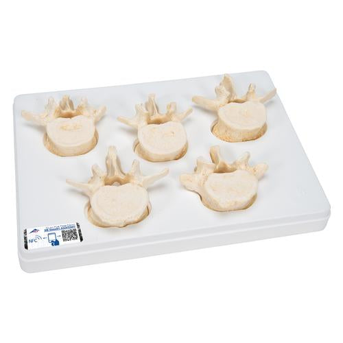 Set of 5 BONElike Lumbar Vertebrae - 3B Smart Anatomy