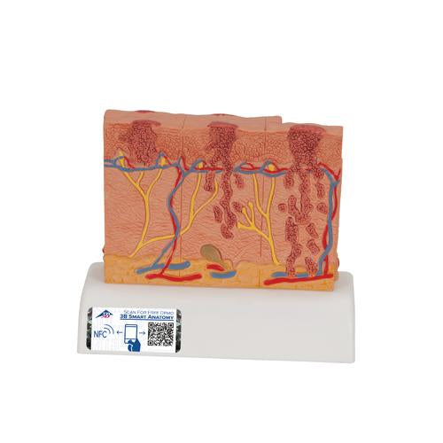 Image 5 - SKIN CANCER MODEL WITH 5 STAGES, 8 TIMES MAGNIFIED - 3B SMART ANATOMY