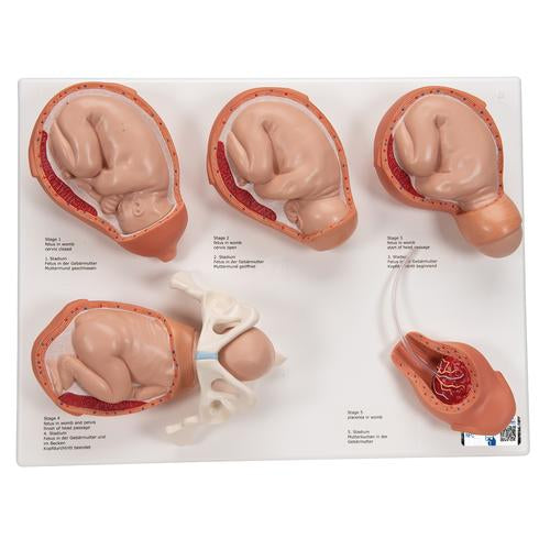 Labor Stages Model, Small - 3B Smart Anatomy