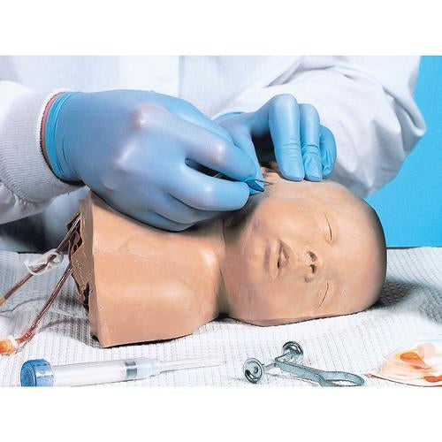 Image 2 - PAEDIATRIC HEAD