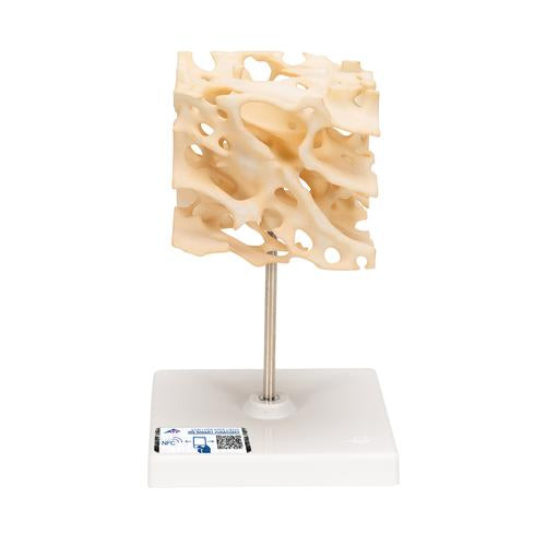Human Cancellous Bone Model, Enlarged 100 times - 3B Smart Anatomy