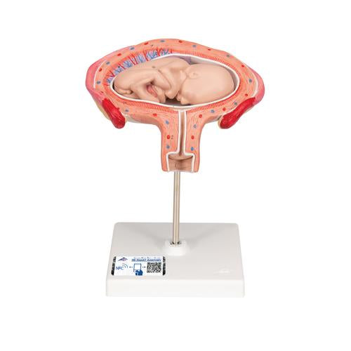 Fetus Model, 4th Month in Abdominal Position - 3B Smart Anatomy