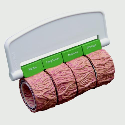 Artery sections (4) (oversized) - with Handle