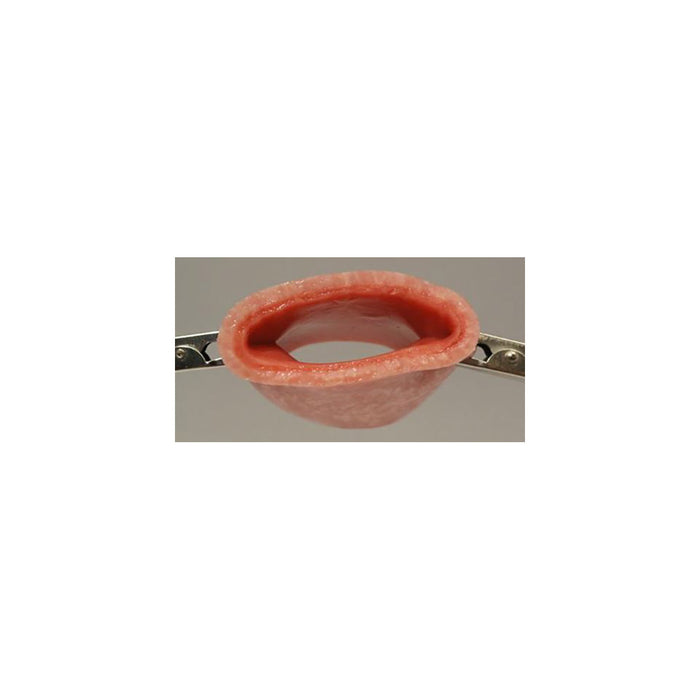 Vaginal cuff (2" wet)