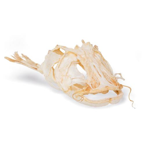 Deluxe Human Osteoporosis Model (3 Vertebrae with Discs ), Removable on Stand - 3B Smart Anatomy