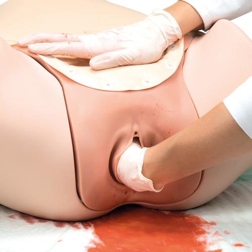 Image 6 - POSTPARTUM HEMORRHAGE TRAINER - PPH TRAINER P97