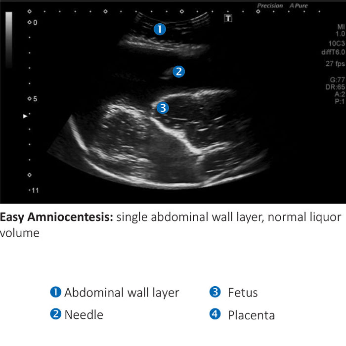 Image 3 - AMNIO ABBY® - ULTRASOUND GUIDED INVASIVE PROCEDURES SIMULATOR