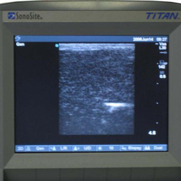 Image 3 - BREAST PROBE MODEL
