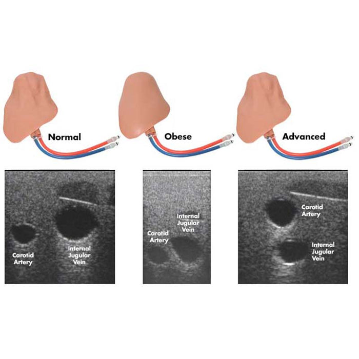 Image 4 - CENTRALINEMAN SYSTEM