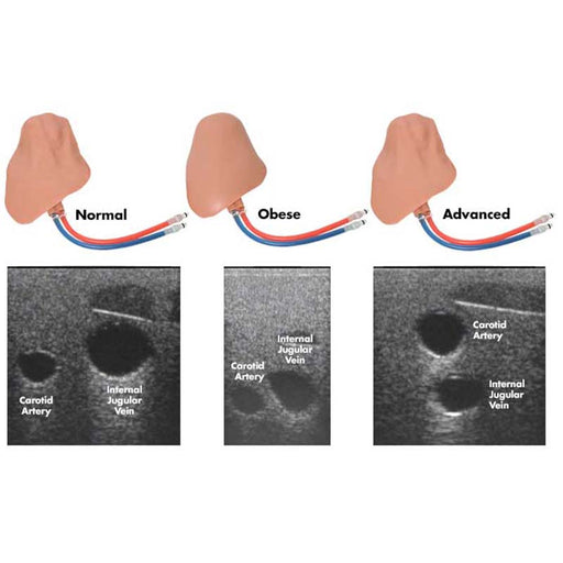 Image 2 - CENTRALINEMAN® SYSTEM WITH ARTICULATING HEAD