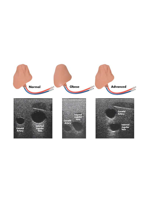 CentraLineMan System Tissue Variety Pack