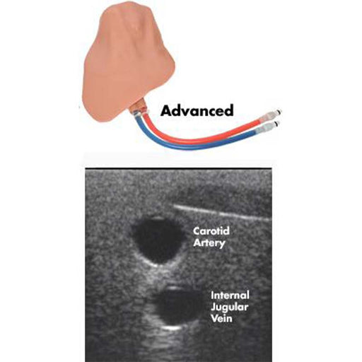 Image 2 - CENTRALINEMAN ADVANCED REPLACEABLE TISSUE