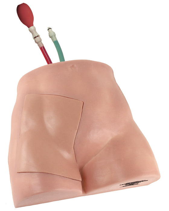 Image 3 - FEMORALINEMAN REPLACEABLE TISSUE
