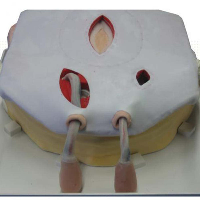 Image 2 - HERNIA MODEL