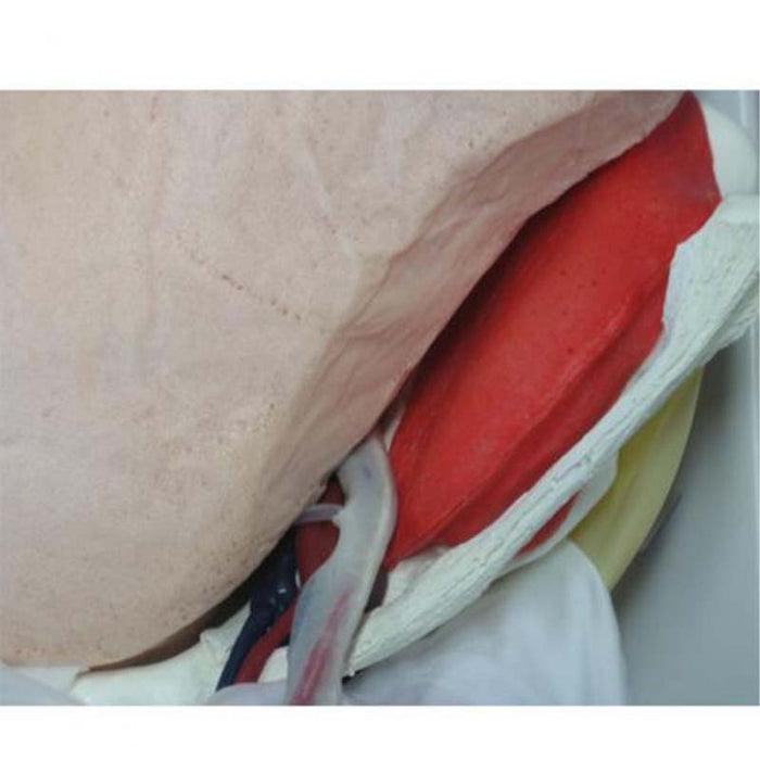 Image 3 - HERNIA MODEL
