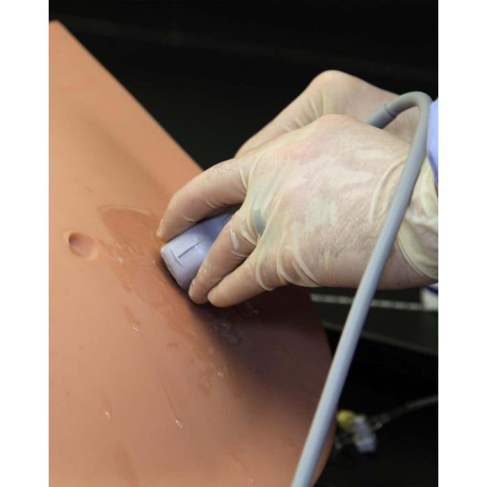 Image 4 - ULTRASOUND PARACENTESIS TRAINING PACKAGE