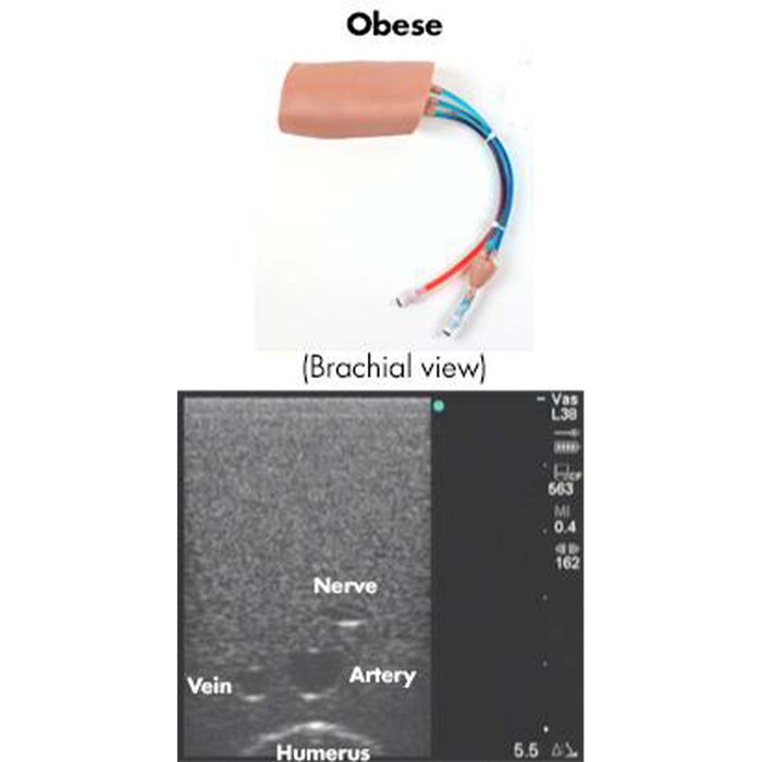 Image 2 - PICCLINEMAN REPLACEABLE OBESE TISSUE
