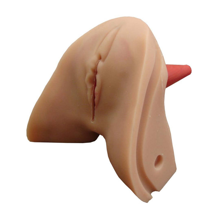 Perineal Repair Replaceable Tissue