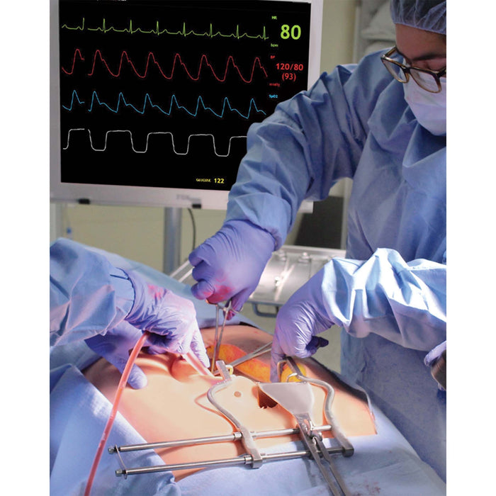 Universal Surgical Abdomen Team Training System