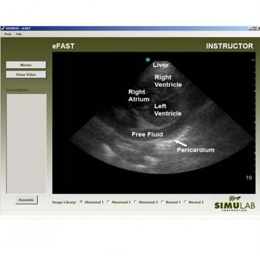 Image 2 - SONOMAN DIAGNOSTIC ULTRASOUND SIMULATOR