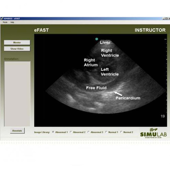 Image 2 - SONOMAN DIAGNOSTIC ULTRASOUND SIMULATOR