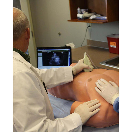 Image 2 - EFAST MODULE FOR SONOMAN SYSTEM DIAGNOSTIC ULTRASOUND TRAINER