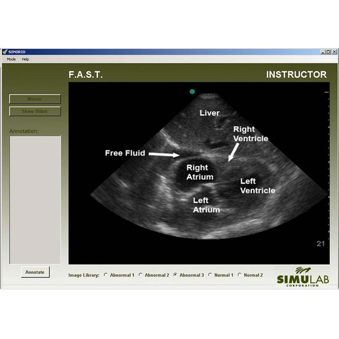 FAST Module for SonoMan System Diagnostic Ultrasound Trainer