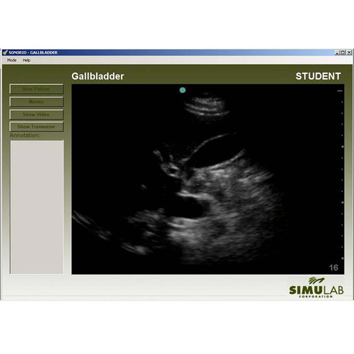 Image 2 - GALLBLADDER MODULE FOR SONOMAN SYSTEM DIAGNOSTIC ULTRASOUND