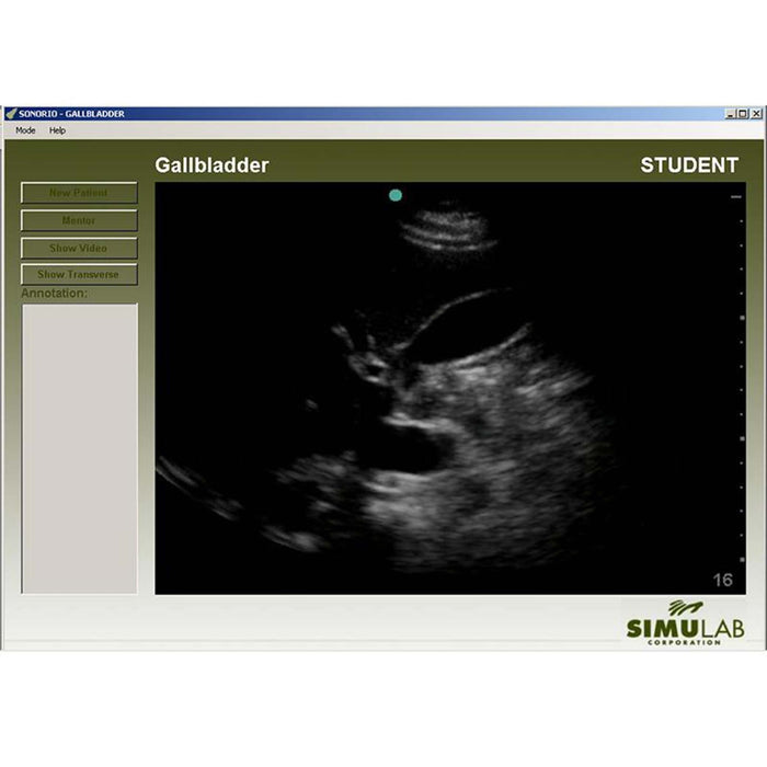 Image 2 - GALLBLADDER MODULE FOR SONOMAN SYSTEM DIAGNOSTIC ULTRASOUND