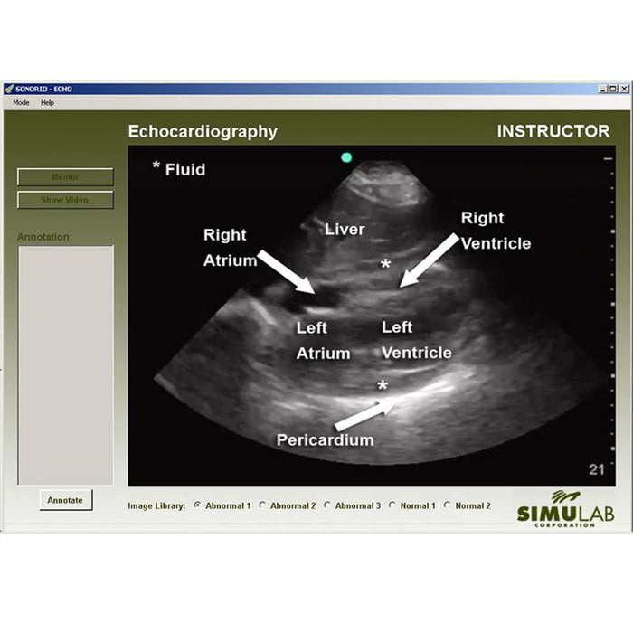Image 4 - SONOMAN DIAGNOSTIC ULTRASOUND SIMULATOR TRAINING PACKAGE