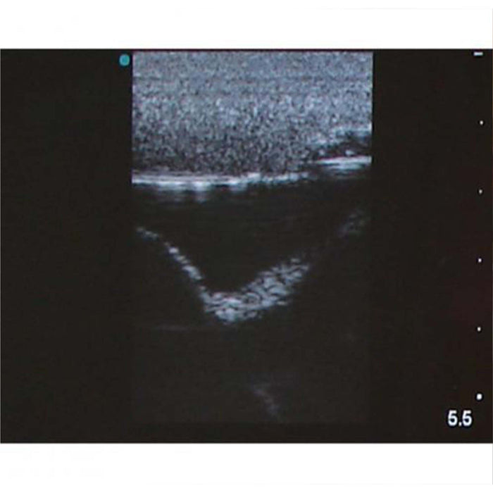 Image 5 - ULTRASOUND THORACENTESIS MODEL