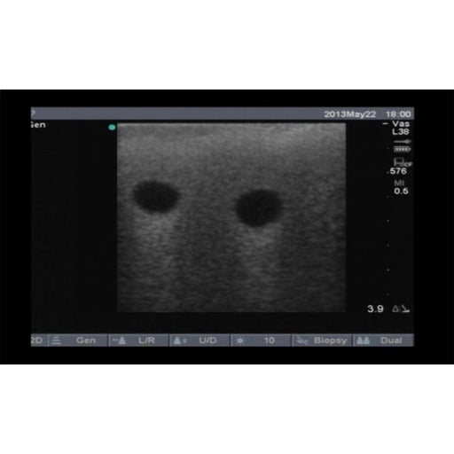 Image 2 - VASCULARACCESSCHILD FEMORAL REPLACEMENT TISSUE