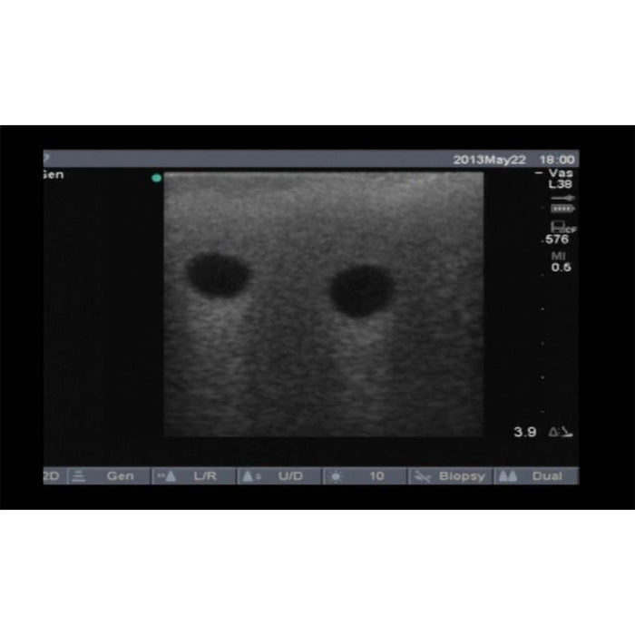 Image 2 - VASCULARACCESSCHILD TRAINING PACKAGE