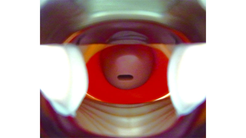Image 3 - CERVICAL CANCER SCREENING PARTS