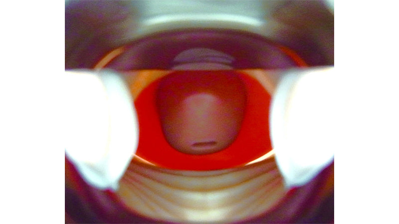 Image 4 - CERVICAL CANCER SCREENING PARTS
