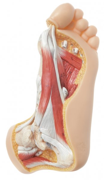 Hallux valgus model