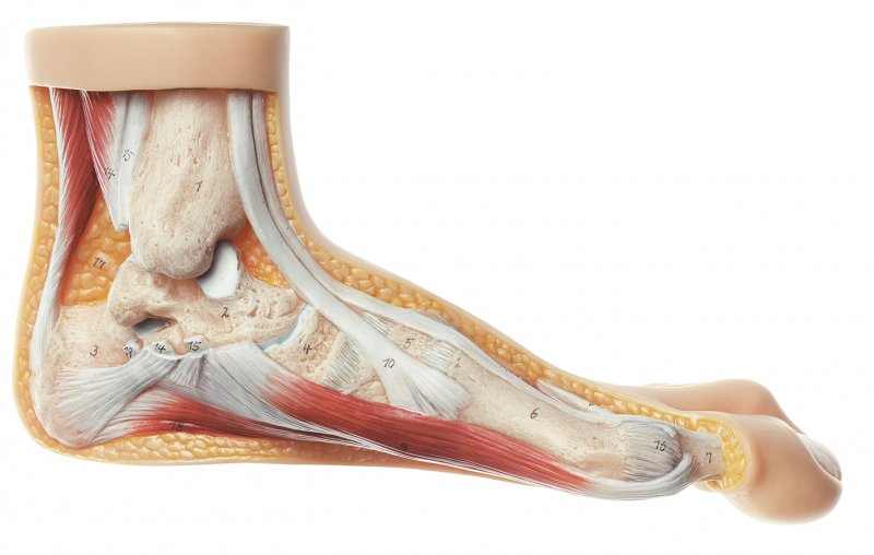 Hallux valgus model