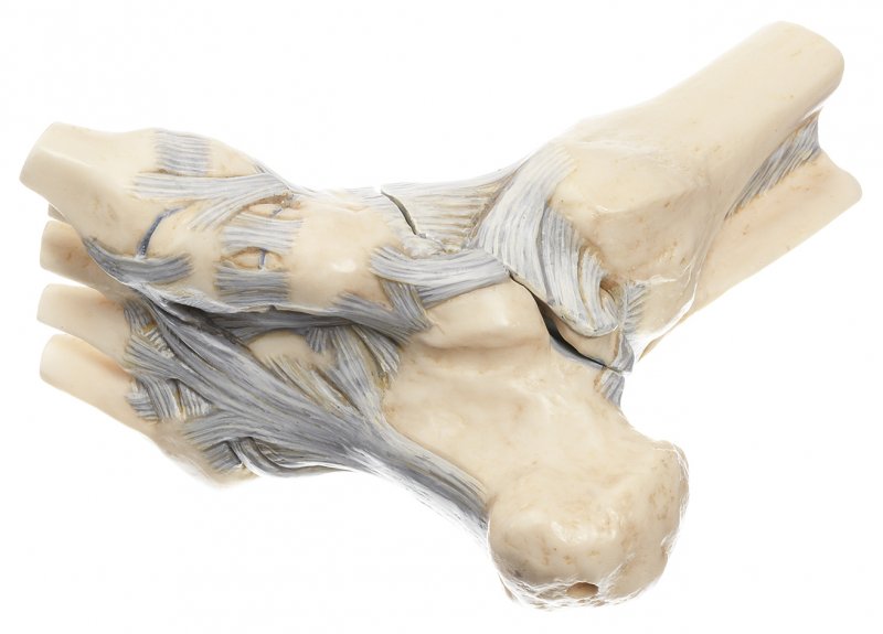 Ligaments of the Ankle with Open Talonavicular Joint