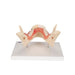 Image 4 - DENTAL DISEASE MODEL, MAGNIFIED 2 TIMES, 21 PARTS - 3B SMART ANATOMY