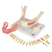 Image 5 - DENTAL DISEASE MODEL, MAGNIFIED 2 TIMES, 21 PARTS - 3B SMART ANATOMY