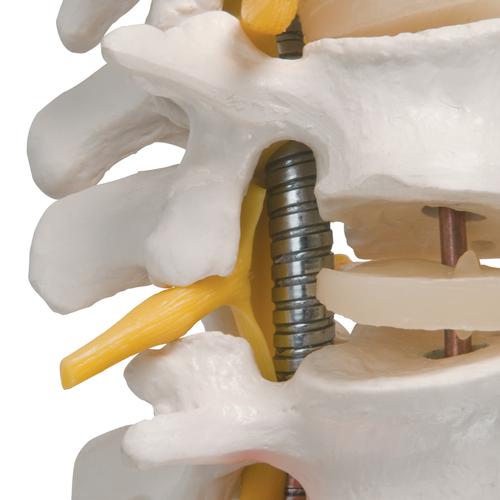 Image 5 - HIGHLY FLEXIBLE HUMAN SPINE MODEL, MOUNTED ON A FLEXIBLE CORE - 3B SMART ANATOMY