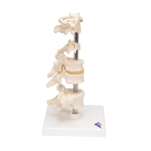 Image 4 - MODEL OF 6 HUMAN VERTEBRAE, MOUNTED ON STAND (ATLAS, AXIS, CERVICAL, 2X THORACIC, LUMBAR) - 3B SMART ANATOMY