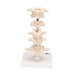 Image 5 - MODEL OF 6 HUMAN VERTEBRAE, MOUNTED ON STAND (ATLAS, AXIS, CERVICAL, 2X THORACIC, LUMBAR) - 3B SMART ANATOMY