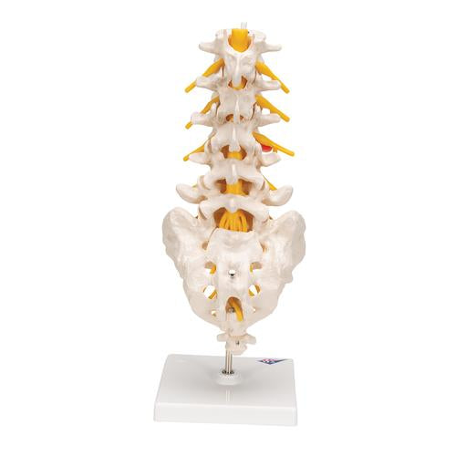 Image 5 - HUMAN LUMBAR SPINAL COLUMN MODEL WITH DORSO-LATERAL PROLAPSED INTERVERTEBRAL DISC - 3B SMART ANATOMY