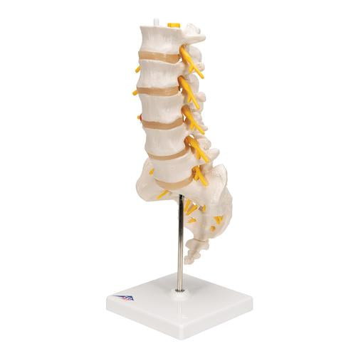 Image 6 - HUMAN LUMBAR SPINAL COLUMN MODEL WITH DORSO-LATERAL PROLAPSED INTERVERTEBRAL DISC - 3B SMART ANATOMY