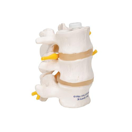 Image 3 - 3 HUMAN LUMBAR VERTEBRAE, FLEXIBLY MOUNTED - 3B SMART ANATOMY