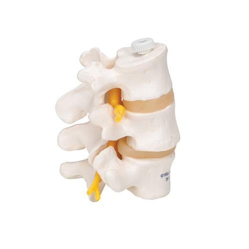 Image 4 - 3 HUMAN LUMBAR VERTEBRAE, FLEXIBLY MOUNTED - 3B SMART ANATOMY