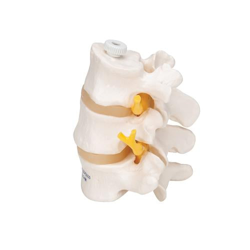 Image 6 - 3 HUMAN LUMBAR VERTEBRAE, FLEXIBLY MOUNTED - 3B SMART ANATOMY