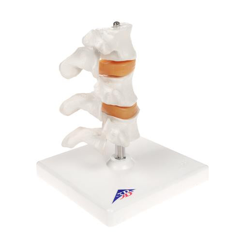 Image 4 - DELUXE HUMAN OSTEOPOROSIS MODEL (3 VERTEBRAE WITH DISCS ), REMOVABLE ON STAND - 3B SMART ANATOMY